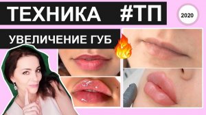 Техника ТП увеличение губ Емельяна Брауде
