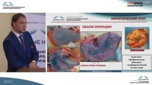 Рак полости рта и глотки