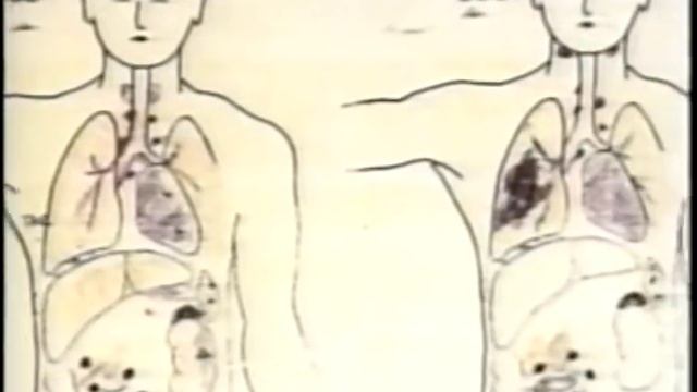 Unit 731 Japanese Biological Warfare Program WWII смотреть онлайн