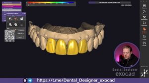 Exocad Stream / New ARTiPoly / Buganov CHARISMA (NewTooth library)