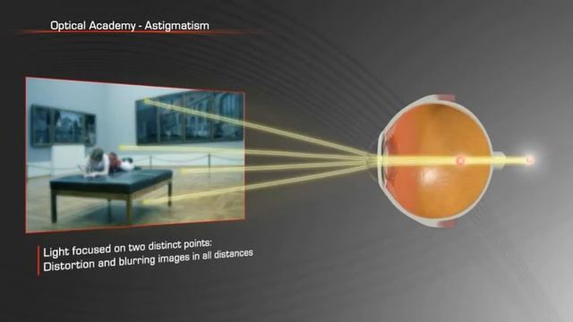 Астигматизм смотреть онлайн