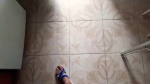 #Перелом большой #берцовой кости #остеосинтез | 2,5 месяца уже хожу!