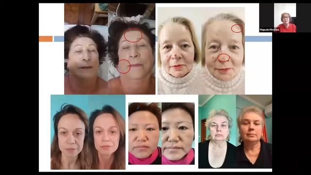 Отзыв Марьям о приборе Активатор Клеток