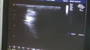 Носенко Е.М. Исследование сосудов верхних конечностей!