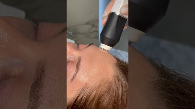 GeneO+ RF-лифтинг + Карбокситерапия + Ультрафонофорез + Массаж смотреть онлайн