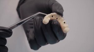 ИМПЛАНТАЦИЯ " ВСЁ НА 4 " / Центр имплантации зубов Киров