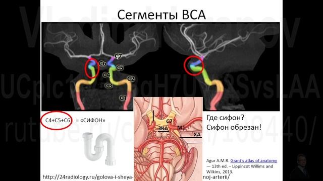 Клиническая и сегментарная анатомия сосудов головного мозга.  Часть 1 (лекционная)