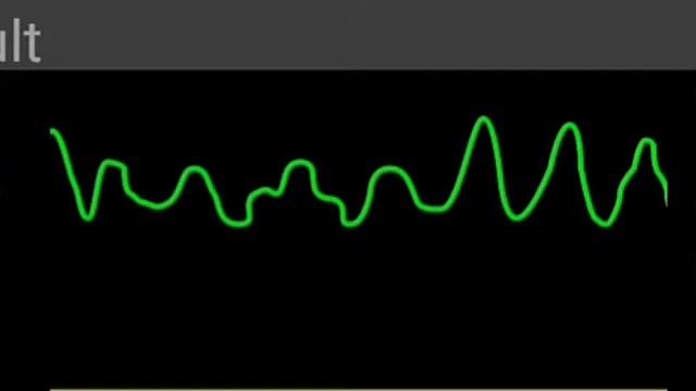 виды остановок сердца смотреть онлайн