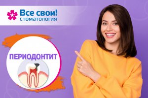Периодонтит. Лечение зубов. Установка пломбы. Кариес. Хронический периодонтит. Острый периодонтит.