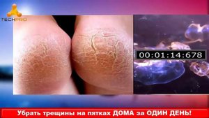 ОТ ТРЕЩИН НА ПЯТКАХ И Следа Не Останется! Рецепт Ванночки…