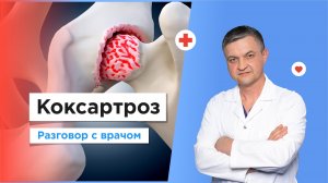 Лечение коксартроза бесплатно по полису ОМС