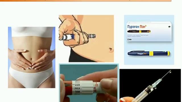 Уколы в живот для стимуляции овуляции. Гормональные уколы в живот. Уколы для эко. Гормональные уколы в живот. Уколы для стимуляции эко.