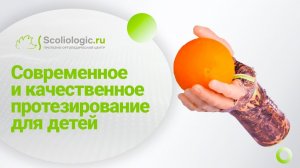 Рабочий протез руки "Капитан Крюк" Тимура Погасяна.