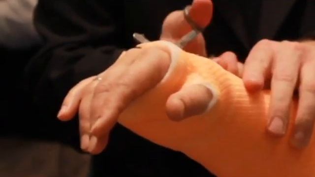 ПТП Примкаст Снятие Бинта смотреть онлайн