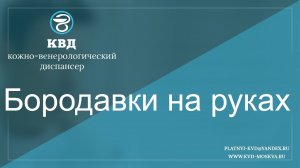 300  Бородавки на руках