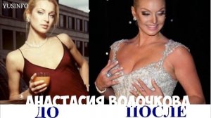 Звезды ДО и ПОСЛЕ пластики. Российский Шоу-бизнес