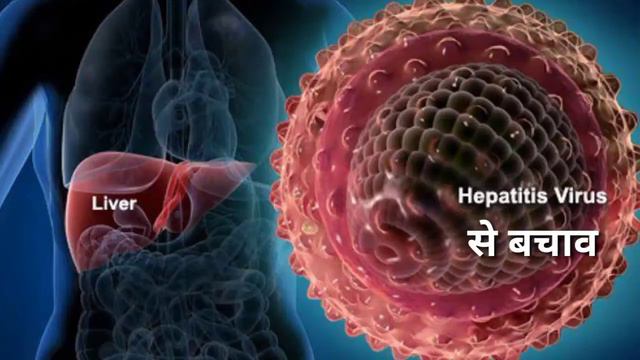 Hepatitis C Test कैसे करते हैं? HCV के लक्षण क्या है? कैसे फैलता है Hepatitis C? HCV से बचने के उपा смотреть онлайн