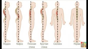 Опора тела и движения