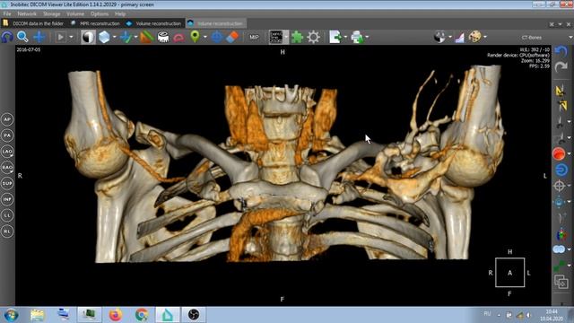 О ТОМ ЧТО МОЖНО УВИДЕТЬ НА КТ . смотреть онлайн