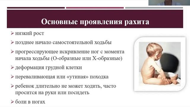 рахит у детей смотреть онлайн