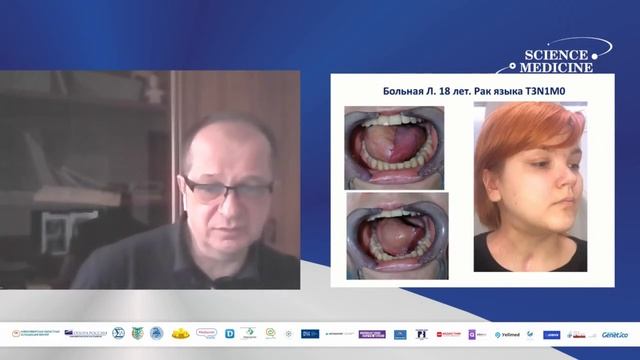 Опухоли головы и шеи: новое в диагностике и лечение