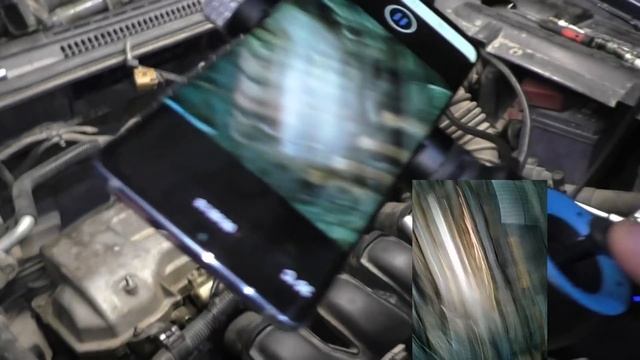 Эндоскопия - развод на бабки или диагностика? смотреть онлайн