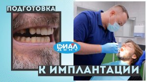Главный врач без зуба? Пора исправлять! Как проходит консультация перед имплантацией в "Диал-Дент"
