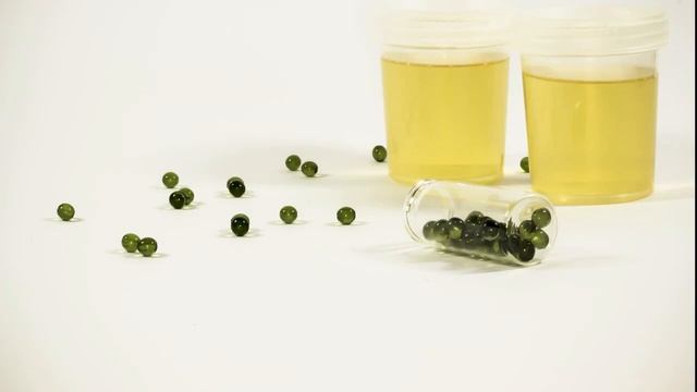 БАКТЕРИИ ВО ВРЕМЯ БЕРЕМЕННОСТИ | Бактериурия у беременных смотреть онлайн