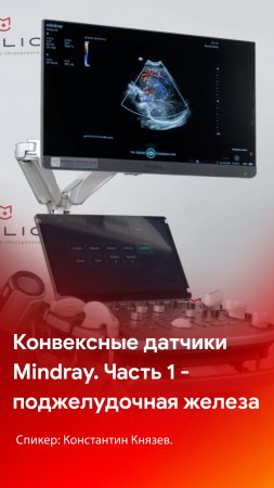 Конвексные датчики Mindray. Поджелудочная железа на датчиках SC6-1s и SC8-2s