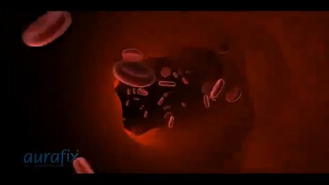 Бандажи для поддержки коленного сустава Aurafix смотреть онлайн