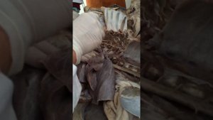 Лимфатические узлы  2