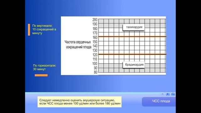 Партограмма (учебный процесс)