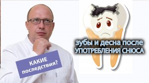 ❓ Что бывает с зубами, деснами и сердцем после употребления снюса? ❌