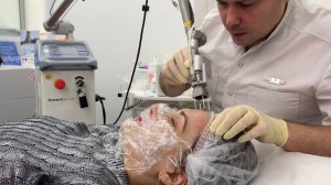 Как ухаживать за лицом после лазерной шлифовки?