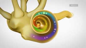 Sensorineural Hearing Loss Occurs in the Cochlea | MED-EL