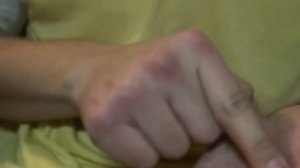 Слезает кожа