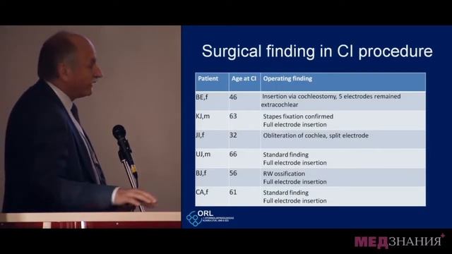 05 Кохлеарная имплантация у пациентов с отосклерозом смотреть онлайн