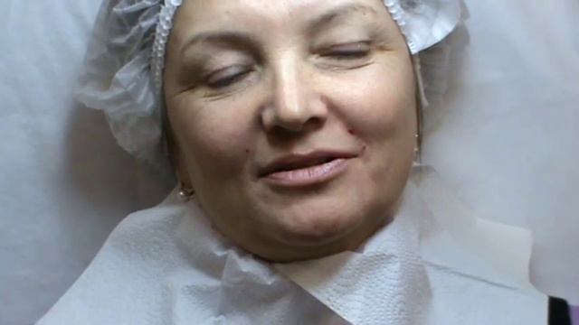 Princess Filler, обучение в Корнеаль, контурная пластика смотреть онлайн