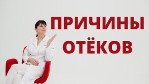 Причины отёков Доктор Лисенкова