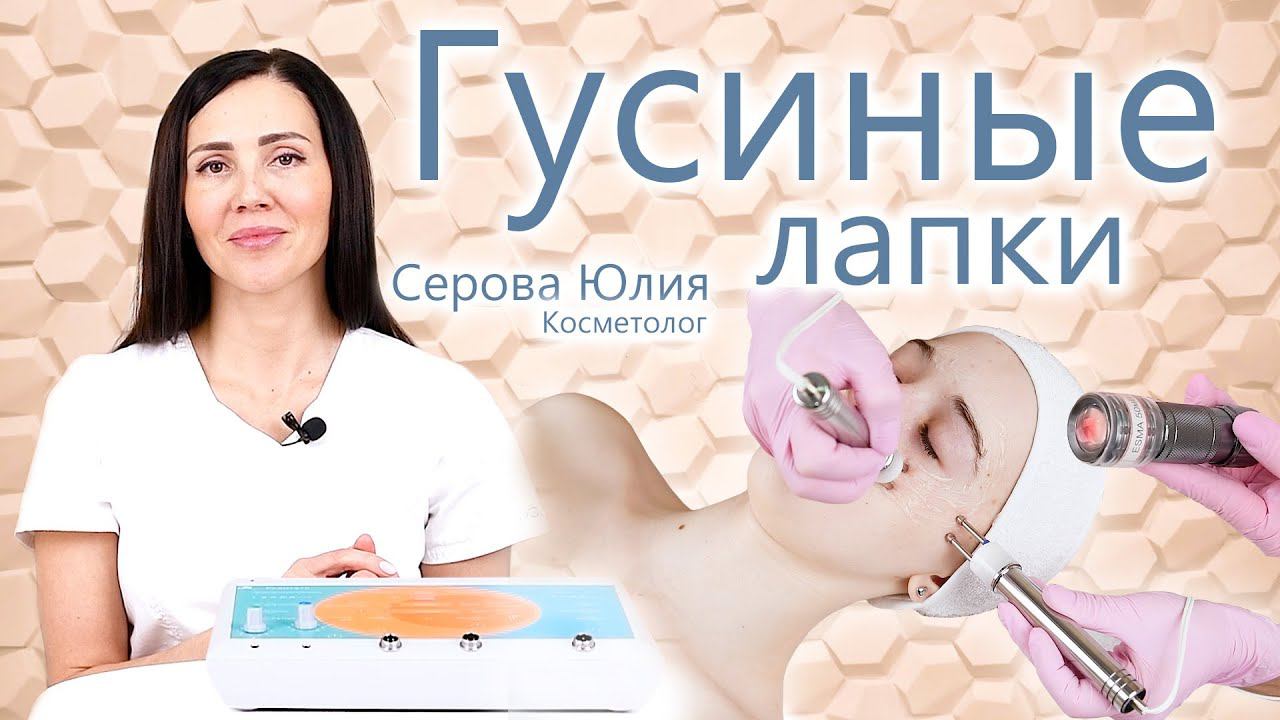 Морщины вокруг глаз. Что такое Гусиные Лапки? Морщины. Косметолог Серова Юлия. ЭСМА.