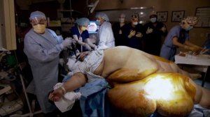 Что стало с самой толстой женщиной в мире. История Майры Розалес