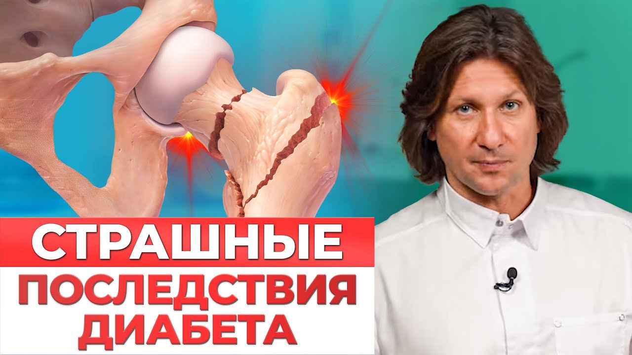 Диабет РАЗРУШИТ ваши кости. Как нехватка инсулина влияет на наш организм