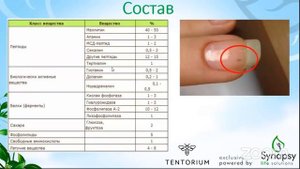 Польза и вред пчелиного яда