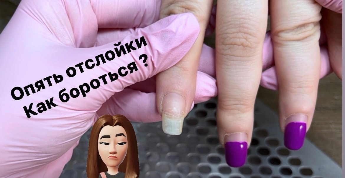 Отслойки!