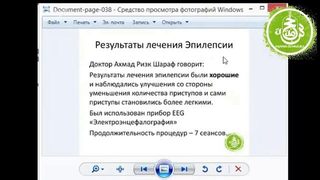 Лечение эпилепсии хиджамой | Обучение Хиджаме