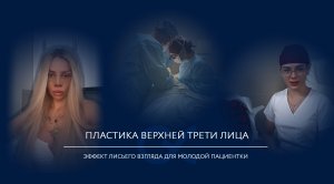 Пластика лба и висков для создания эффекта "лисьего взгляда" 🦊