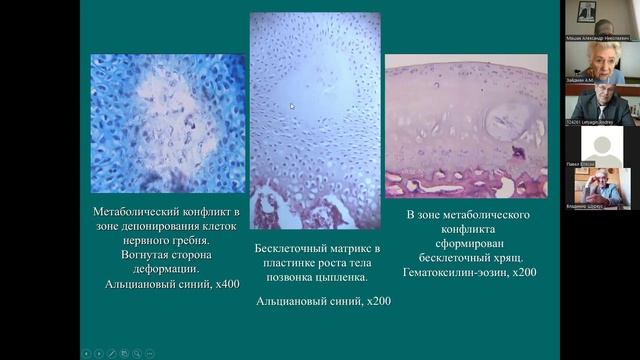 Зайдман А.М. "Pax3-ген – этиологический фактор экспериментального идиопатического сколиоза"