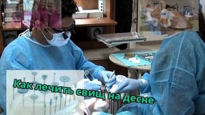 Как лечить свищ на десне