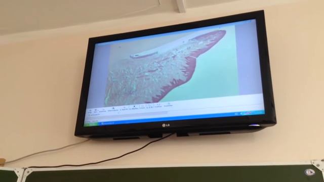 Гистология Десна [Пищеварительная система] смотреть онлайн