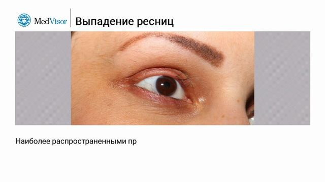 Ресницы рост и выпадение смотреть онлайн